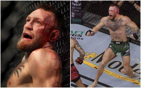 conor mcgregor leg break ,